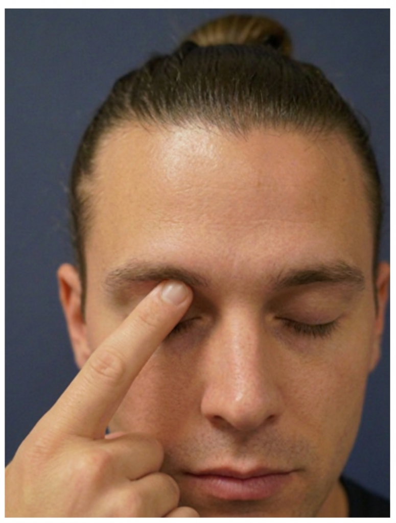 Frontal trigger point