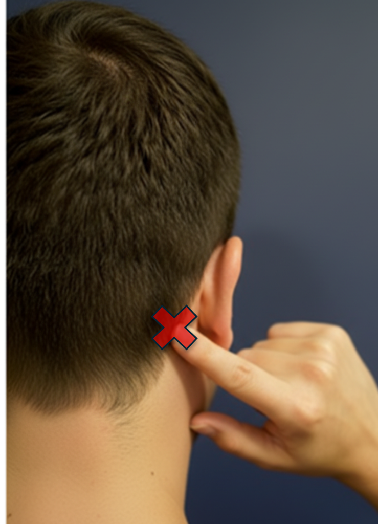 Occipital Migraine View 2